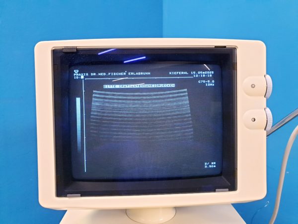 Toshiba Just Vision 400  Justvision 400 SSA-325 + Konvex + Linear – Bild 30