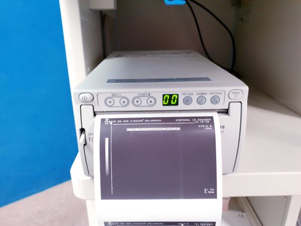 Toshiba Just Vision 400  Justvision 400 SSA-325 + Konvex + Linear – Bild 31