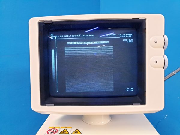 Toshiba Just Vision 400  Justvision 400 SSA-325 + Konvex + Linear – Bild 35
