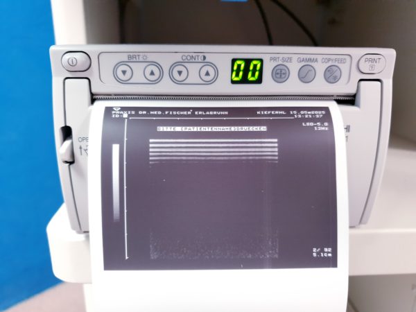 Toshiba Just Vision 400  Justvision 400 SSA-325 + Konvex + Linear – Bild 36