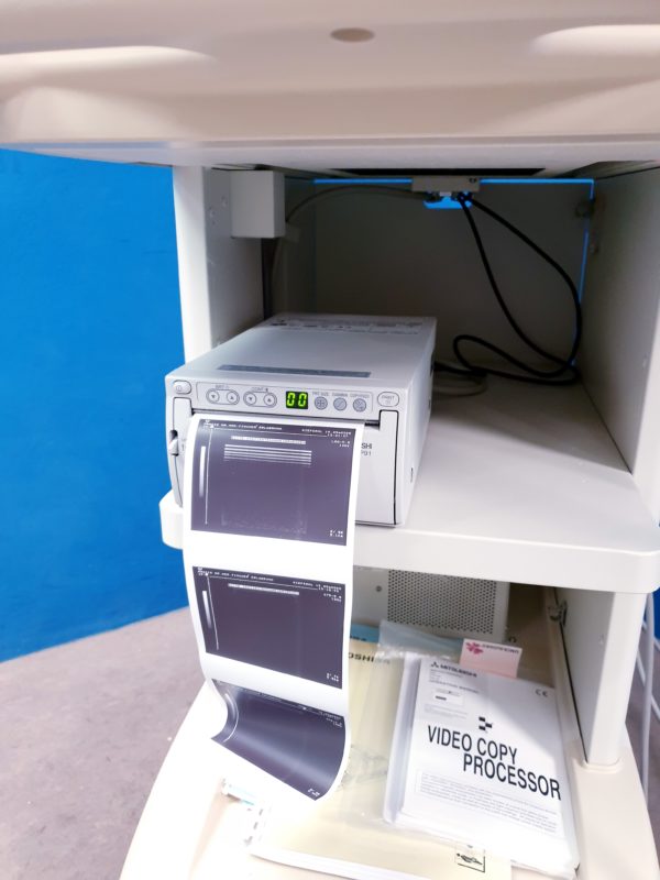 Toshiba Just Vision 400  Justvision 400 SSA-325 + Konvex + Linear – Bild 37