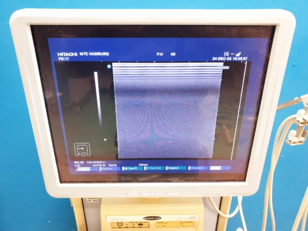 Hitachi EUP-L53 Linear  10.0 - 5.0 MHz Linear – Bild 5