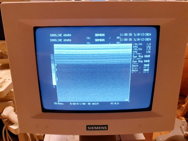 Siemens 7.5L75S Linear Sonde 7.5MHz - Image 3