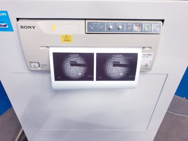 Philips BV 25 - BV25 Gold fahrbarer C-Bogen mit Doppelmonitor – Bild 19