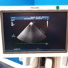 Philips iE33  - IE33 +   S5-1 Echo +  L11-3 Linear Sonde Kardiomaschine - Kardio Ultraschallgerät – Bild 10