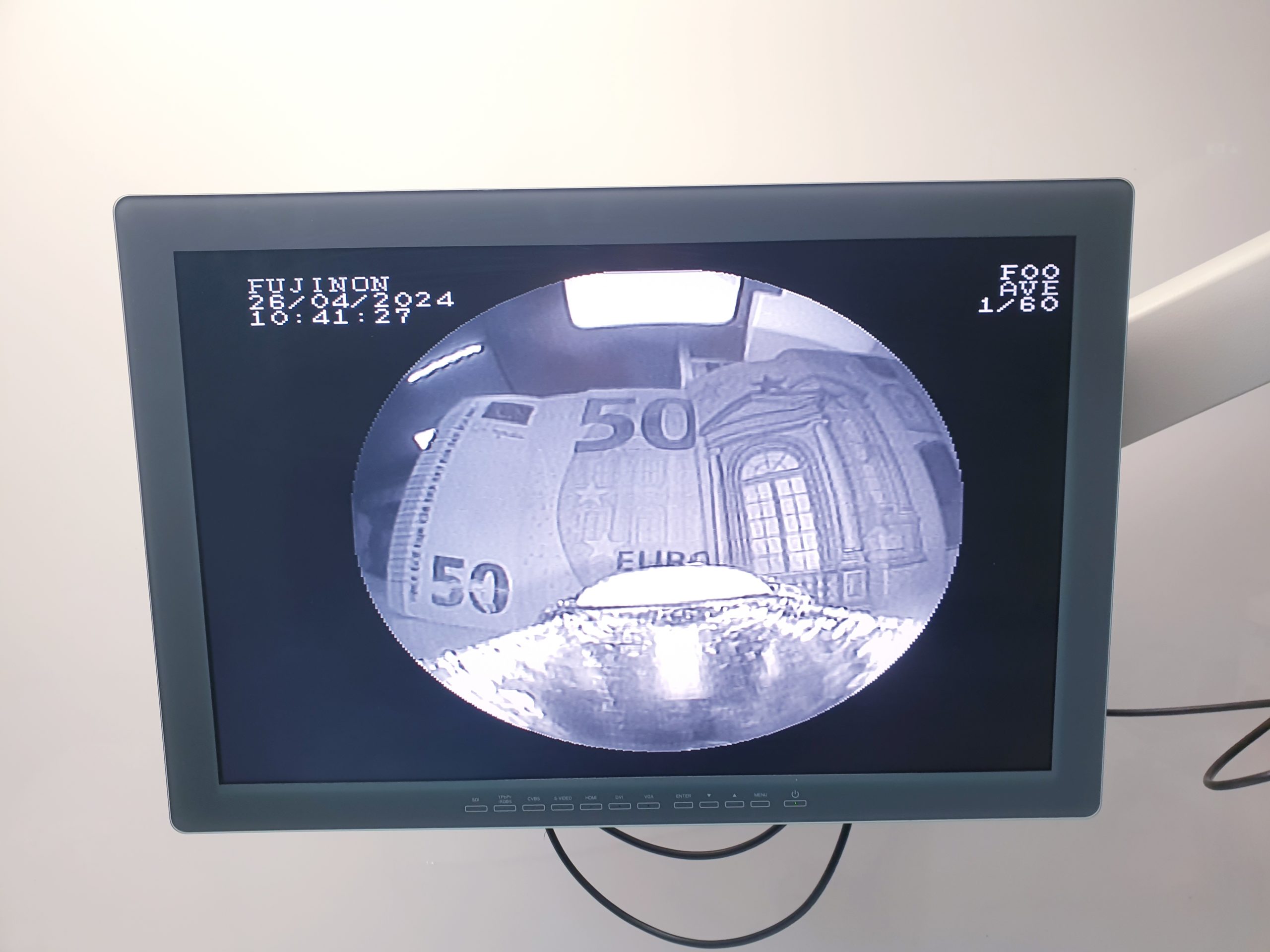 Fujinon EB-530US Video Ultraschall Bronchoskop – Videobronchoskop – Bild 38