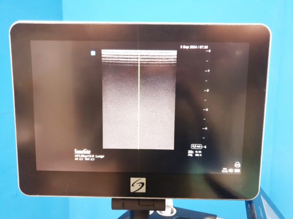 Fuji Sonosite X Porte Ultraschall + HFL38xp + C60xp + P21xp - Image 11