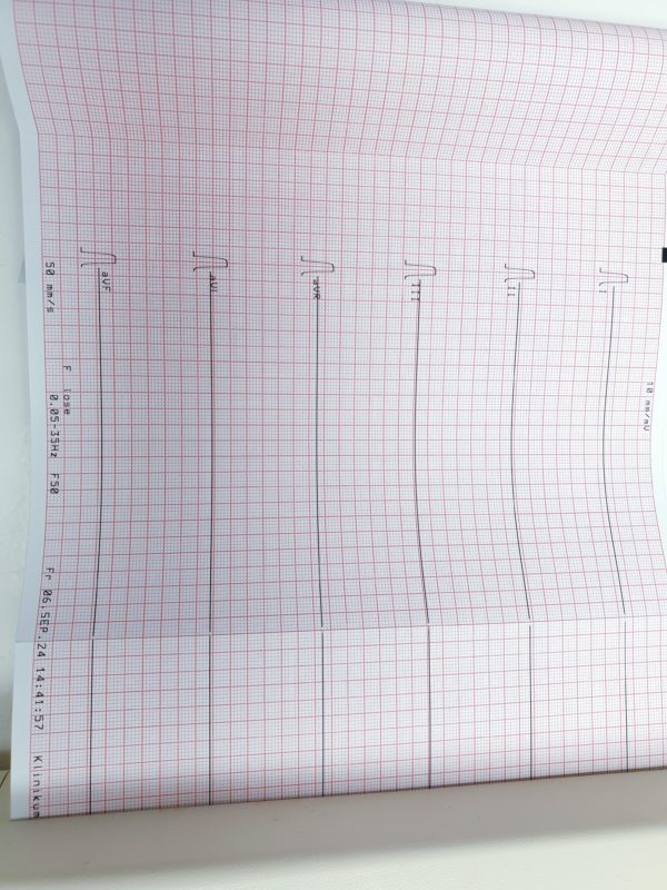 Zimmer Cardiocompact P8000 Power EKG – Gerät - Image 12