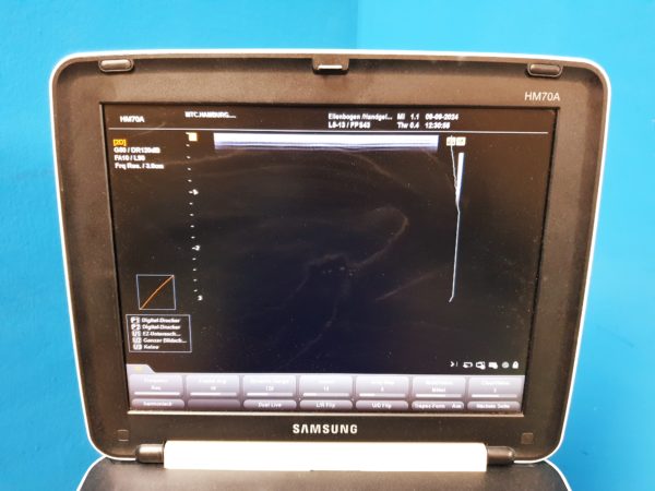 Samsung HM70A + L5-13IS Linear Sonde – Gehäuse hat paar Schäden – DOM 2016 - Image 7