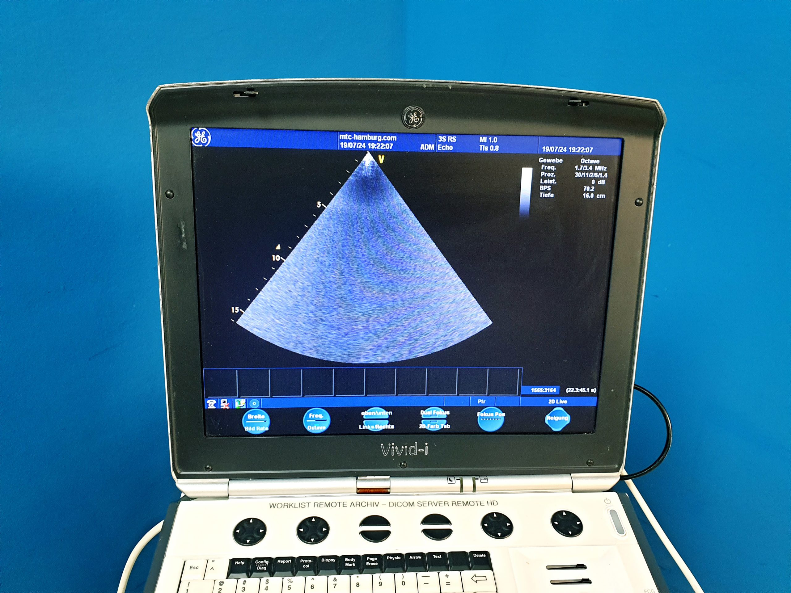 GE Vivid i Ultraschallgerät + 3S + 12S-RS mit 2x Sonden Software Version 2.0.16 auf GE Vivid i Trolley – Bild 9