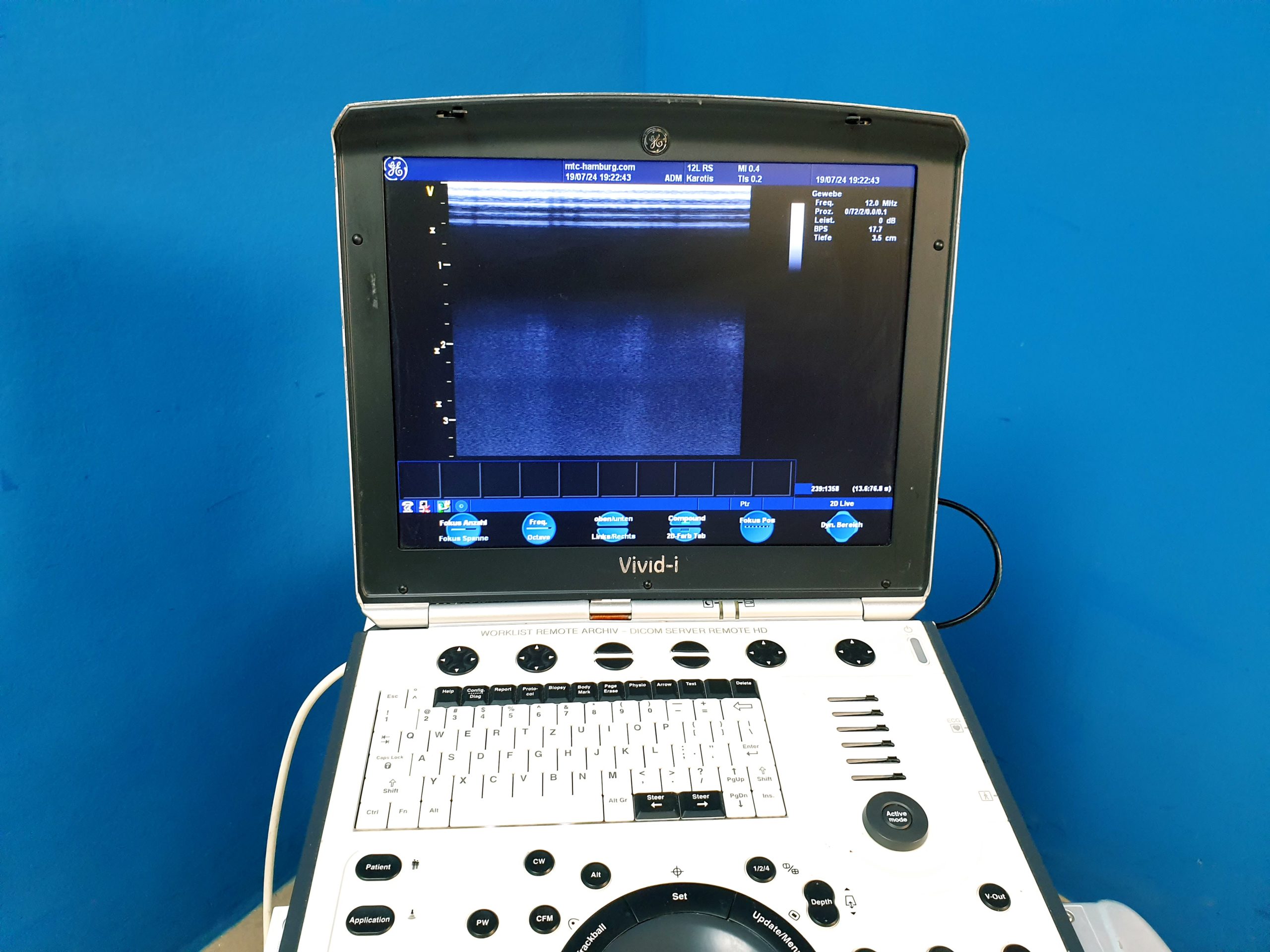 GE Vivid i Ultraschallgerät + 3S + 12S-RS mit 2x Sonden Software Version 2.0.16 auf GE Vivid i Trolley – Bild 12