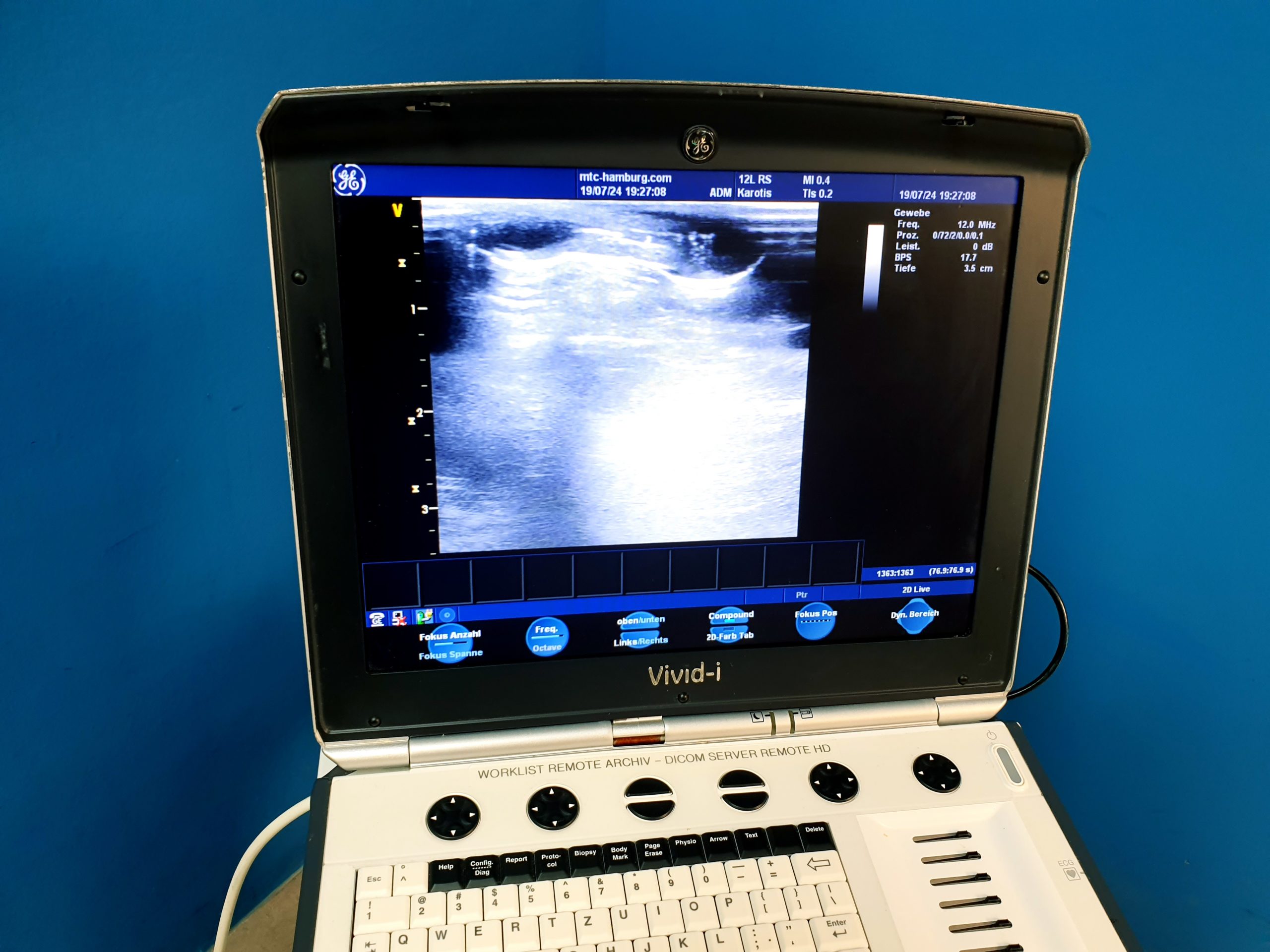 GE Vivid i Ultraschallgerät + 3S + 12S-RS mit 2x Sonden Software Version 2.0.16 auf GE Vivid i Trolley – Bild 14
