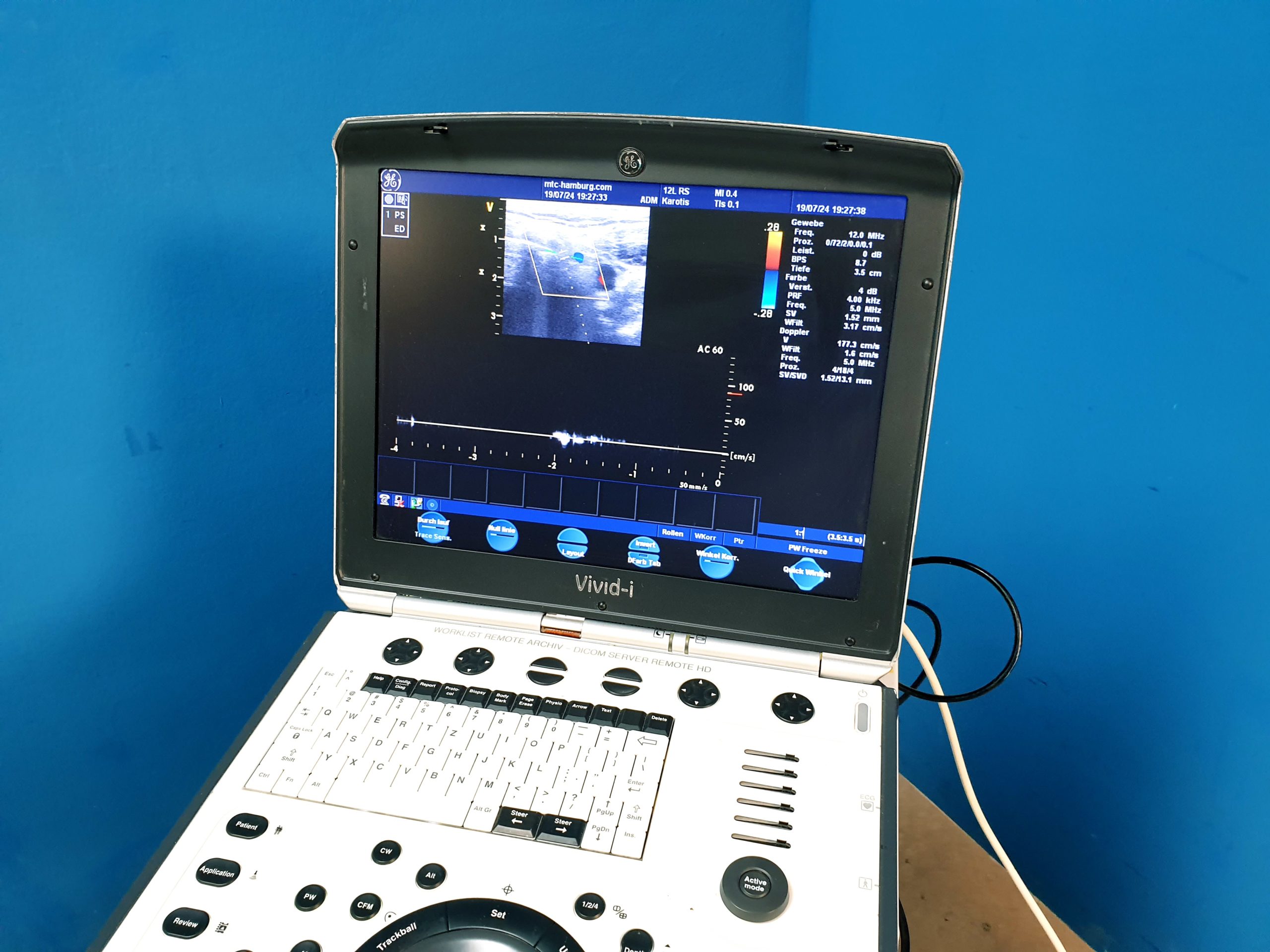 GE Vivid i Ultraschallgerät + 3S + 12S-RS mit 2x Sonden Software Version 2.0.16 auf GE Vivid i Trolley – Bild 16