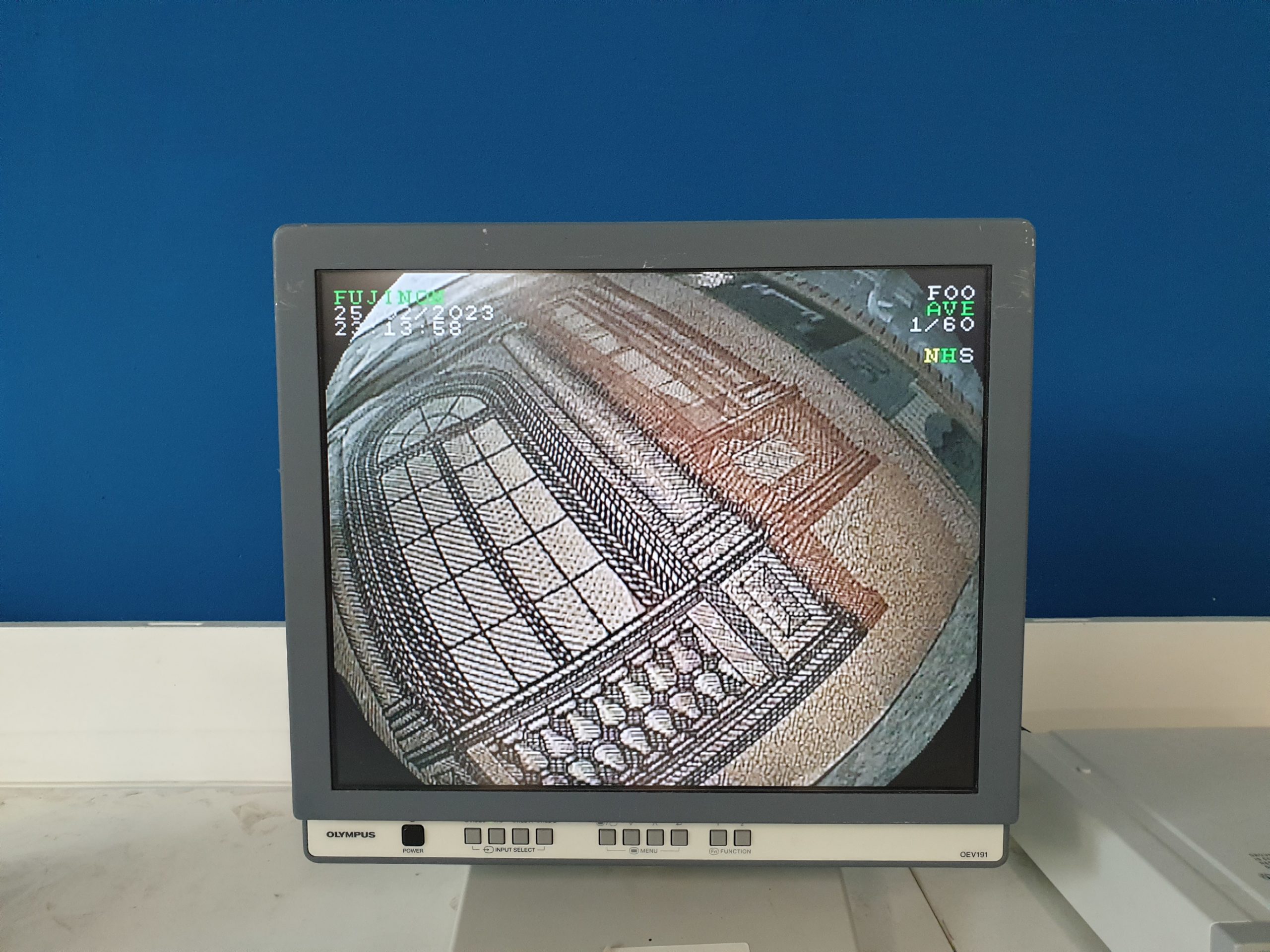 Fujinon Fuji EN-450T5 Enteroskop – Bild 18