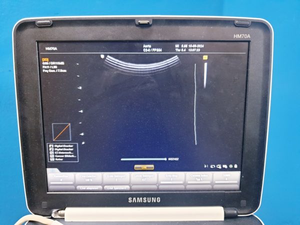 Samsung C2-6 Ultraschallsonde für HM-70A, – Bild 4