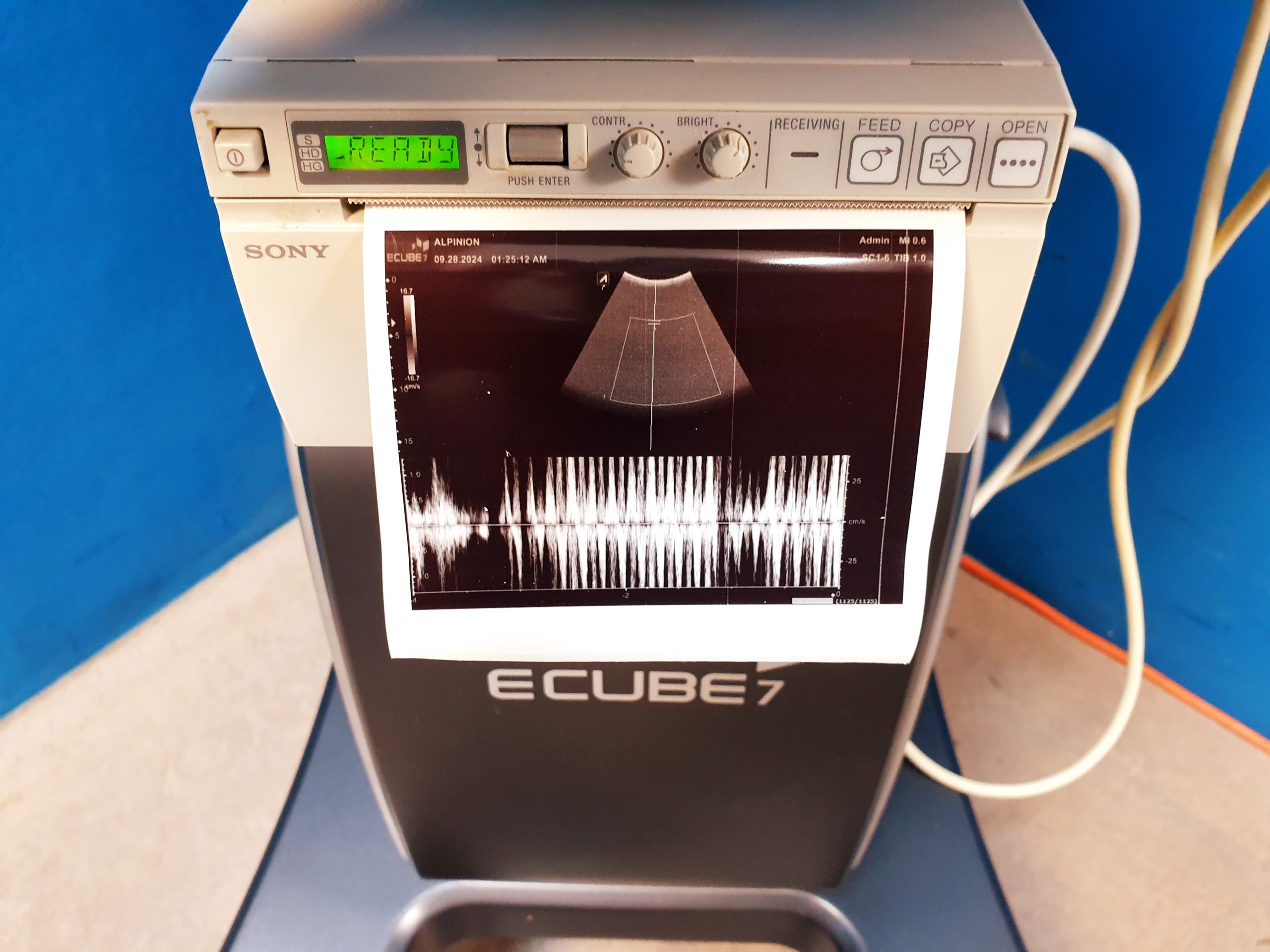 Alpinion E-Cube 7 Farbdoppler + SC1-6 Konvex Sonde – Bild 5