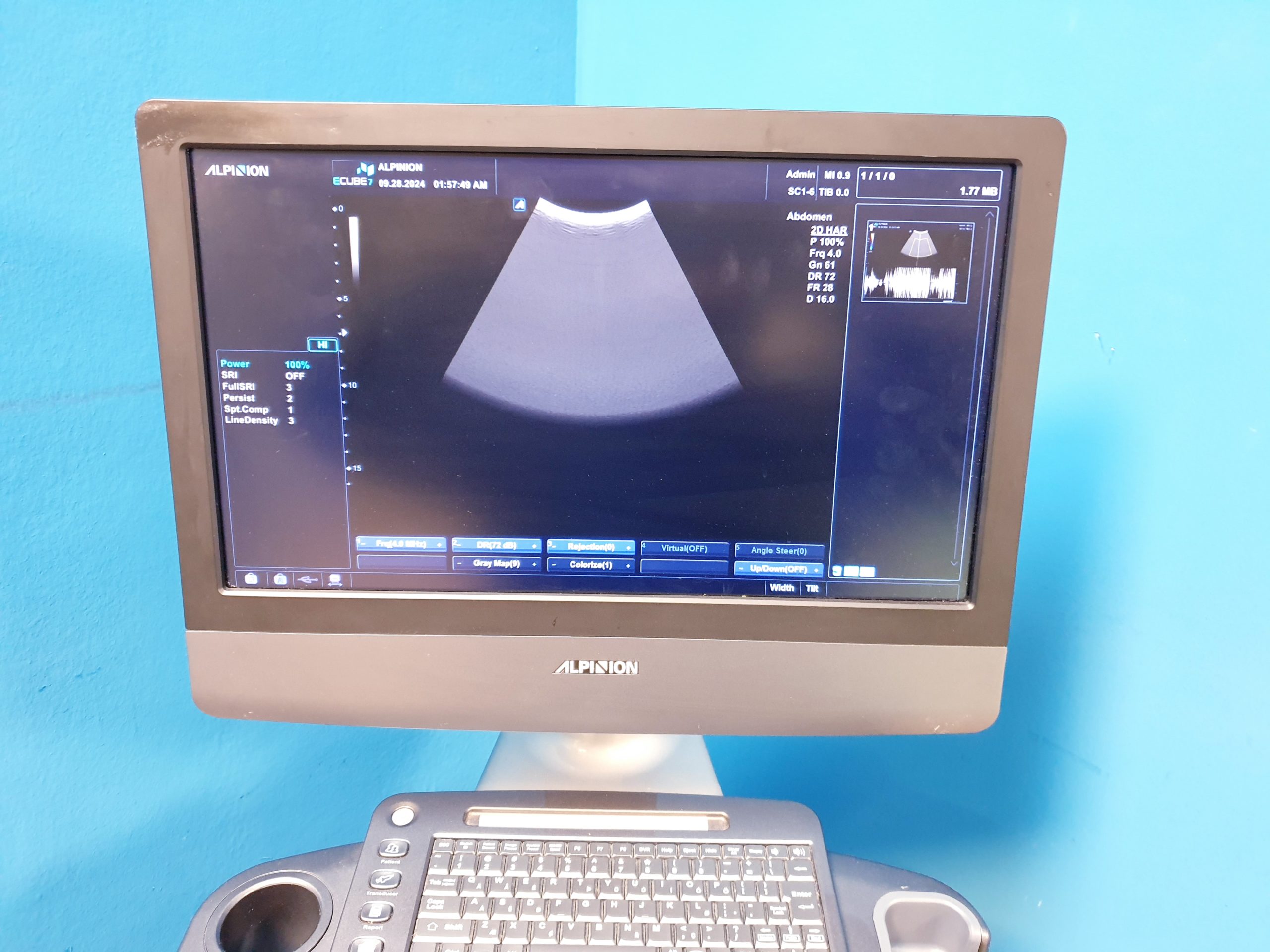 Alpinion E-Cube 7 Farbdoppler + SC1-6 Konvex Sonde – Bild 7