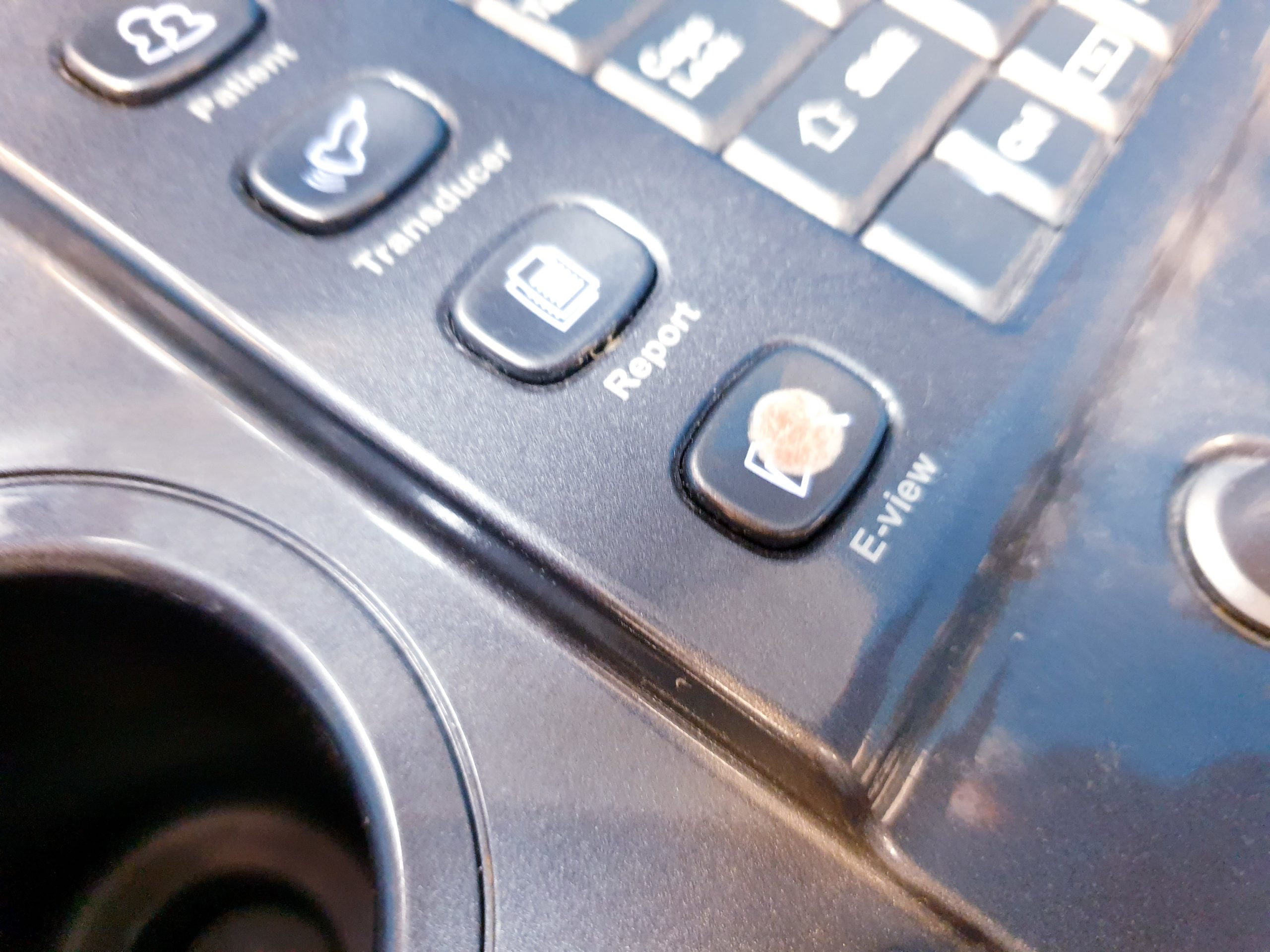 Alpinion E-Cube 7 Farbdoppler + SC1-6 Konvex Sonde – Bild 11