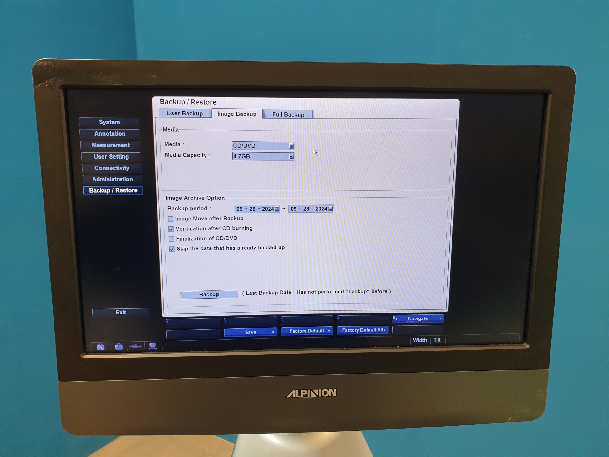 Alpinion E-Cube 7 Farbdoppler + SC1-6 Konvex Sonde – Bild 19