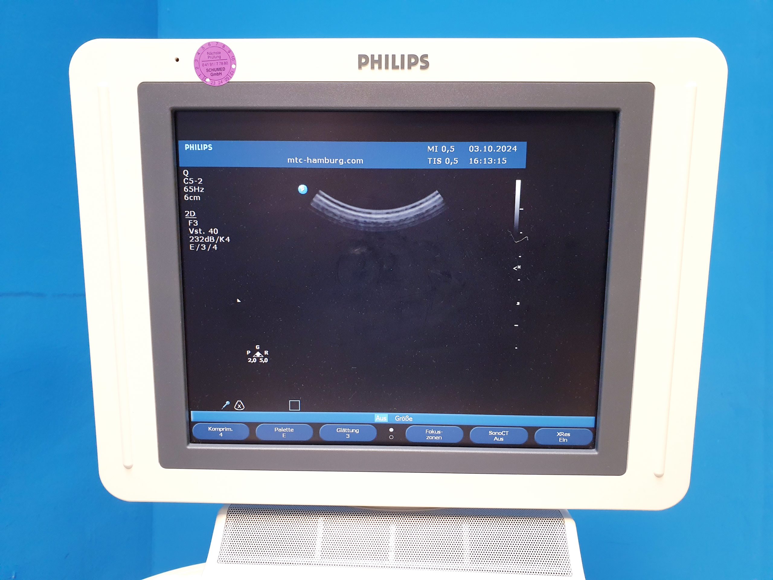 Philips HD11XE – HD 11 XE Farbdoppler+C5-2 Konvex+L12-3 Linear – Bild 11