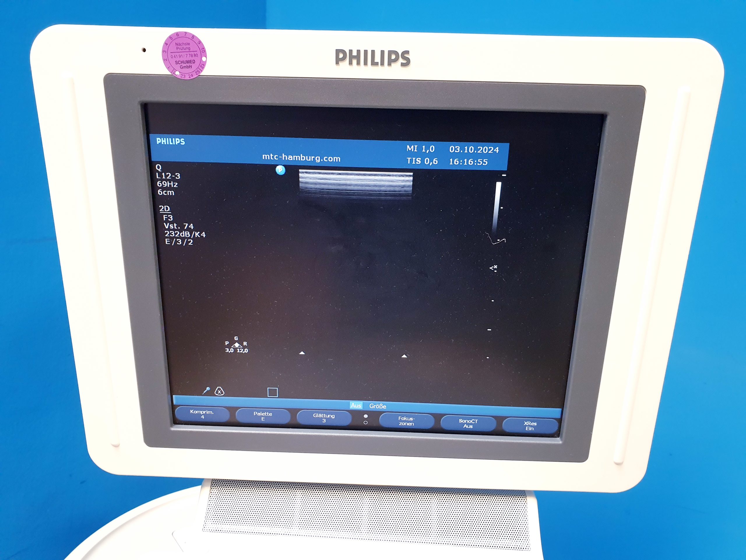 Philips HD11XE – HD 11 XE Farbdoppler+C5-2 Konvex+L12-3 Linear – Bild 16