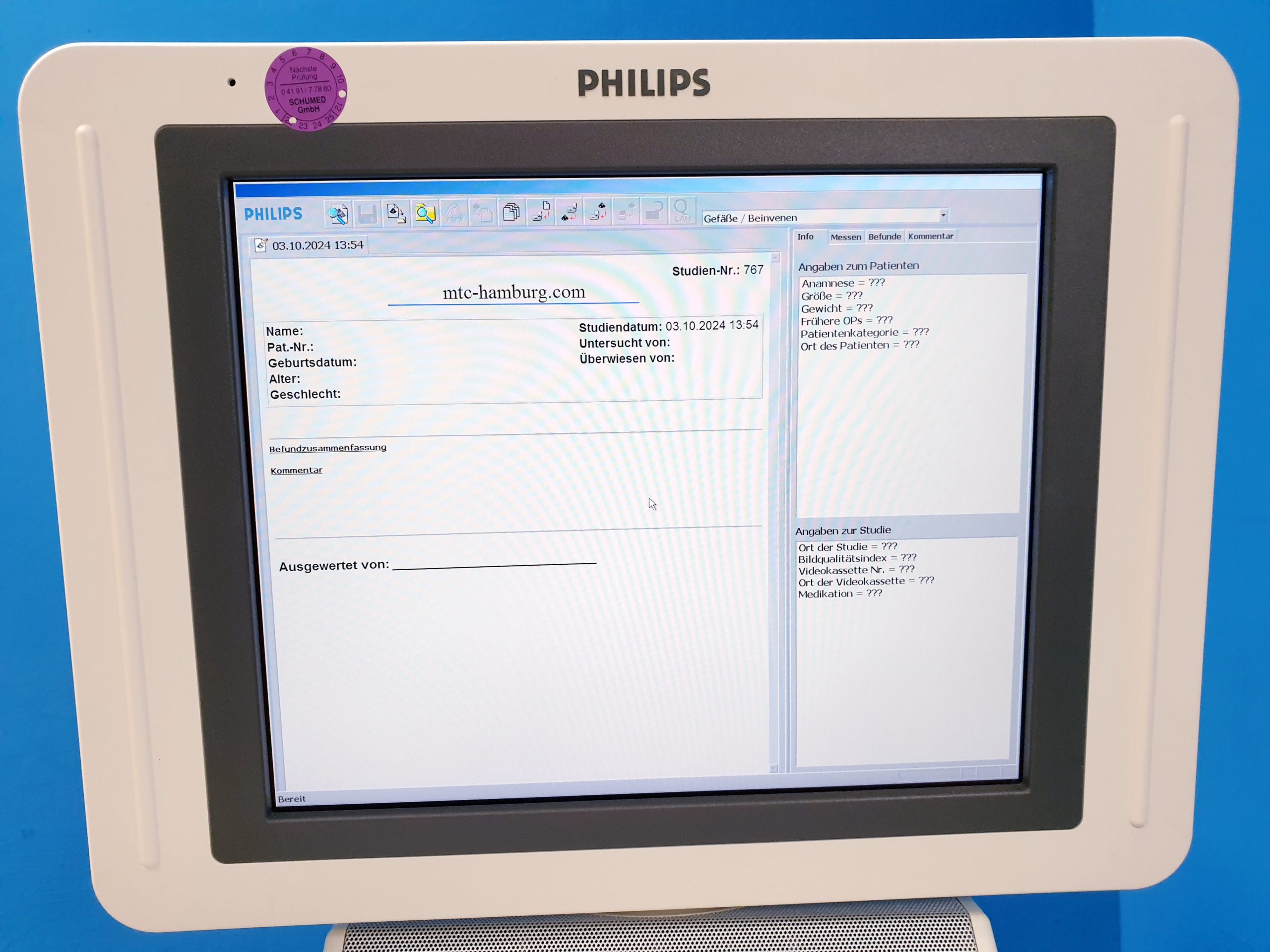 Philips HD11XE – HD 11 XE Farbdoppler+C5-2 Konvex+L12-3 Linear – Bild 18