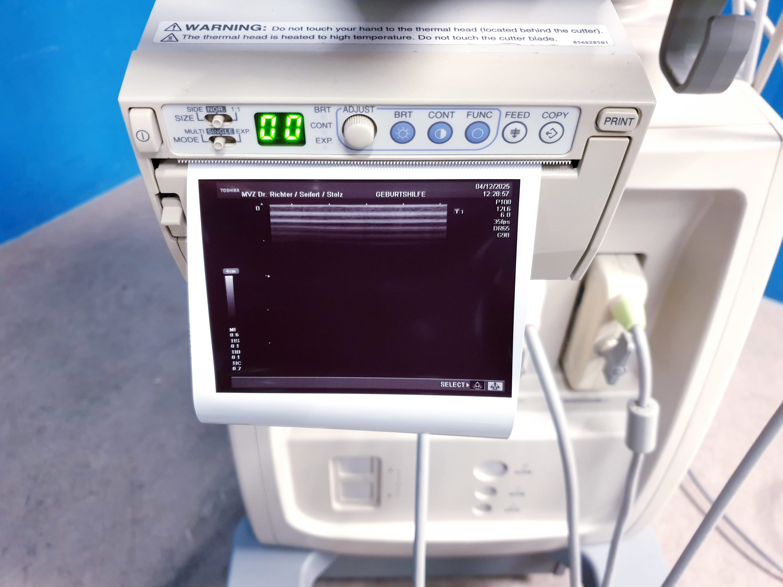 Toshiba PLM-805AT Ultraschall Sonde Linear – Bild 20