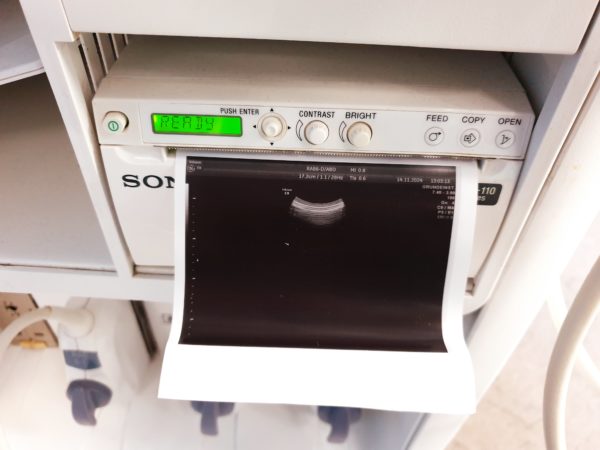 GE Voluson E8- RAB6-D + M6C + 11L-D - DOM 2012 – Bild 15