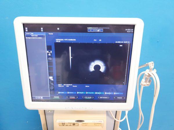 Hitachi EUP-R54A-33 Ref Endocavity Radial - HI VISION AE122024 – Bild 6