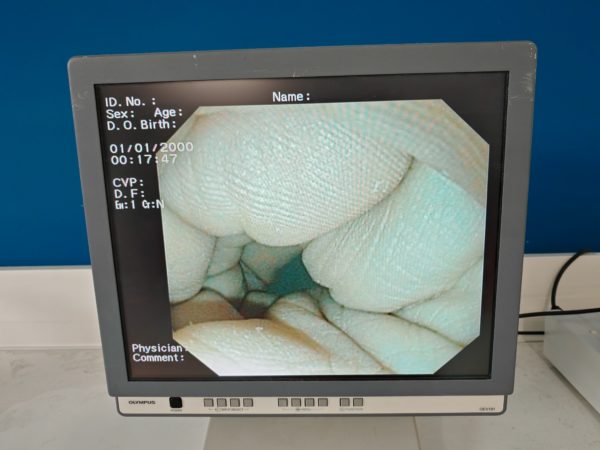 Olympus CV-160 CLV160 MAJ-843 Endoskopie Prozessor + Lichtquelle – Bild 8