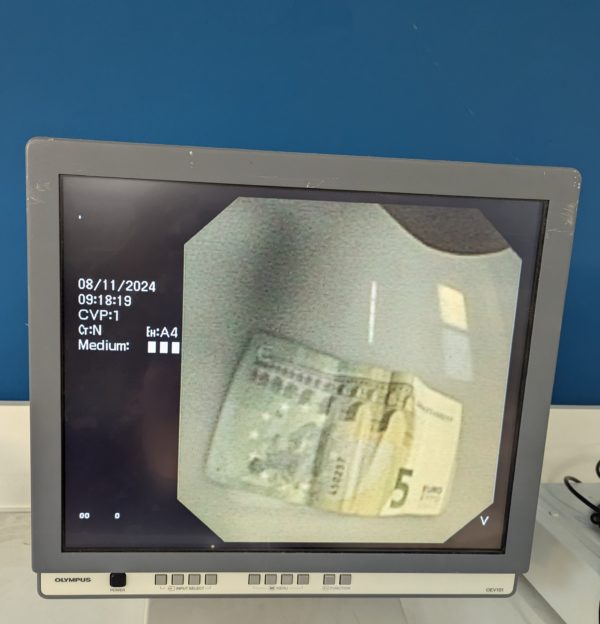 OLYMPUS TJF-160VR TJF-160VR Videoduodenoskop – Bild 14
