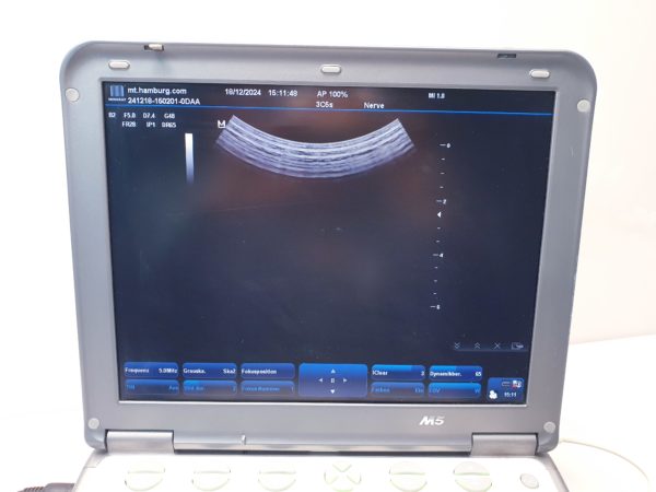 Mindray M5 + 3C5S Konvex +7L4S Linear - Farbdoppler – Bild 8