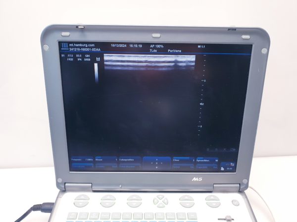 Mindray M5 + 3C5S Konvex +7L4S Linear - Farbdoppler – Bild 17