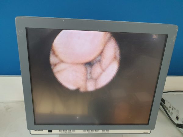 Olympus BF Type TE2 - DEFEKT – Bild 2