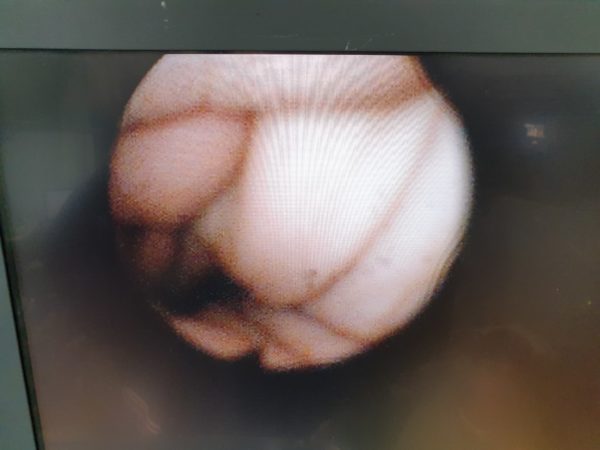 Olympus BF Type TE2 - DEFEKT – Bild 3