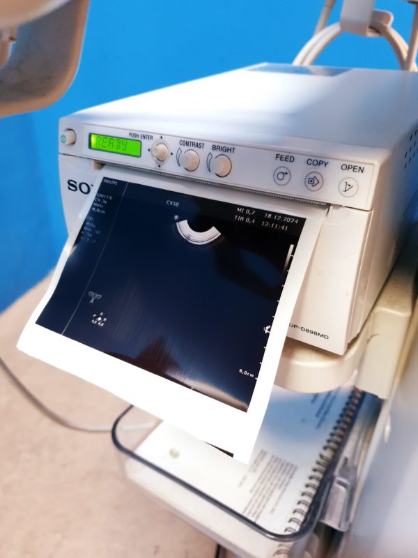 Philips CX50  - CX 50Tragbare Ultraschallgerät  CS-3V +  C5-1 +  L12-3 – Bild 9