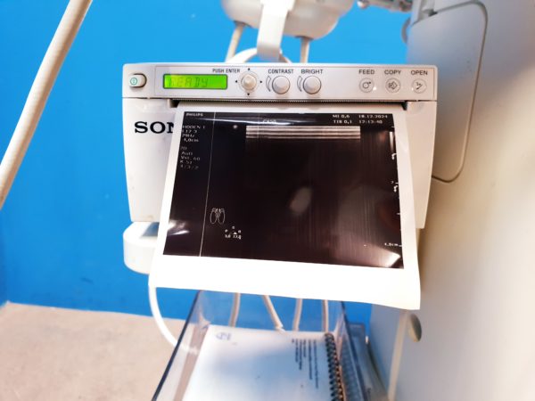 Philips CX50  - CX 50Tragbare Ultraschallgerät  CS-3V +  C5-1 +  L12-3 – Bild 13