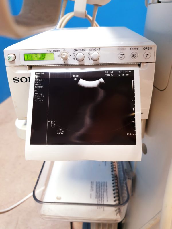 Philips CX50  - CX 50Tragbare Ultraschallgerät  CS-3V +  C5-1 +  L12-3 – Bild 19