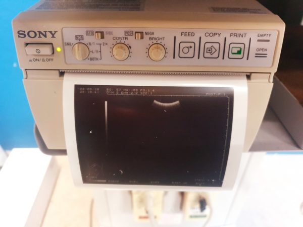 Hitachi - EUP-C314T – Convex Probe - Transducer – Bild 5