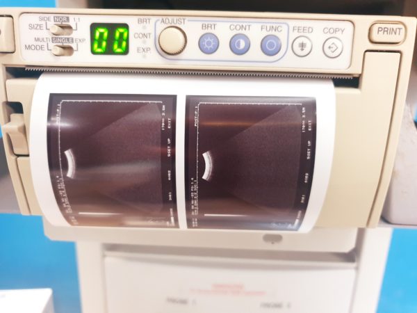 Hitachi - EUP-C314T Konvex Sonde - Probe – Bild 6