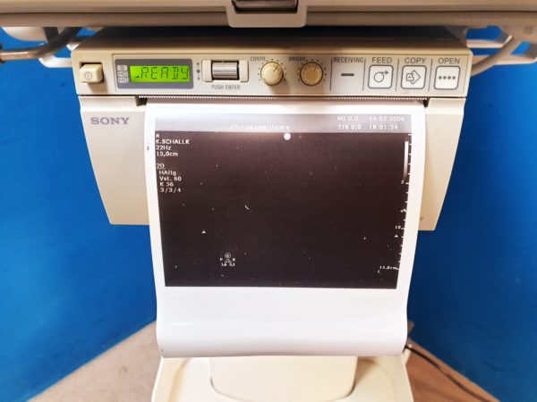 Philips CX50 CX 50 - Ultraschallgerät - Ohne sonden- Vollfunktionsfähig – Bild 5