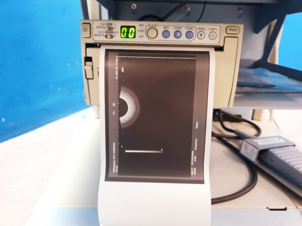 Hitachi EUP-V53w Vaginal Sonde – Bild 3