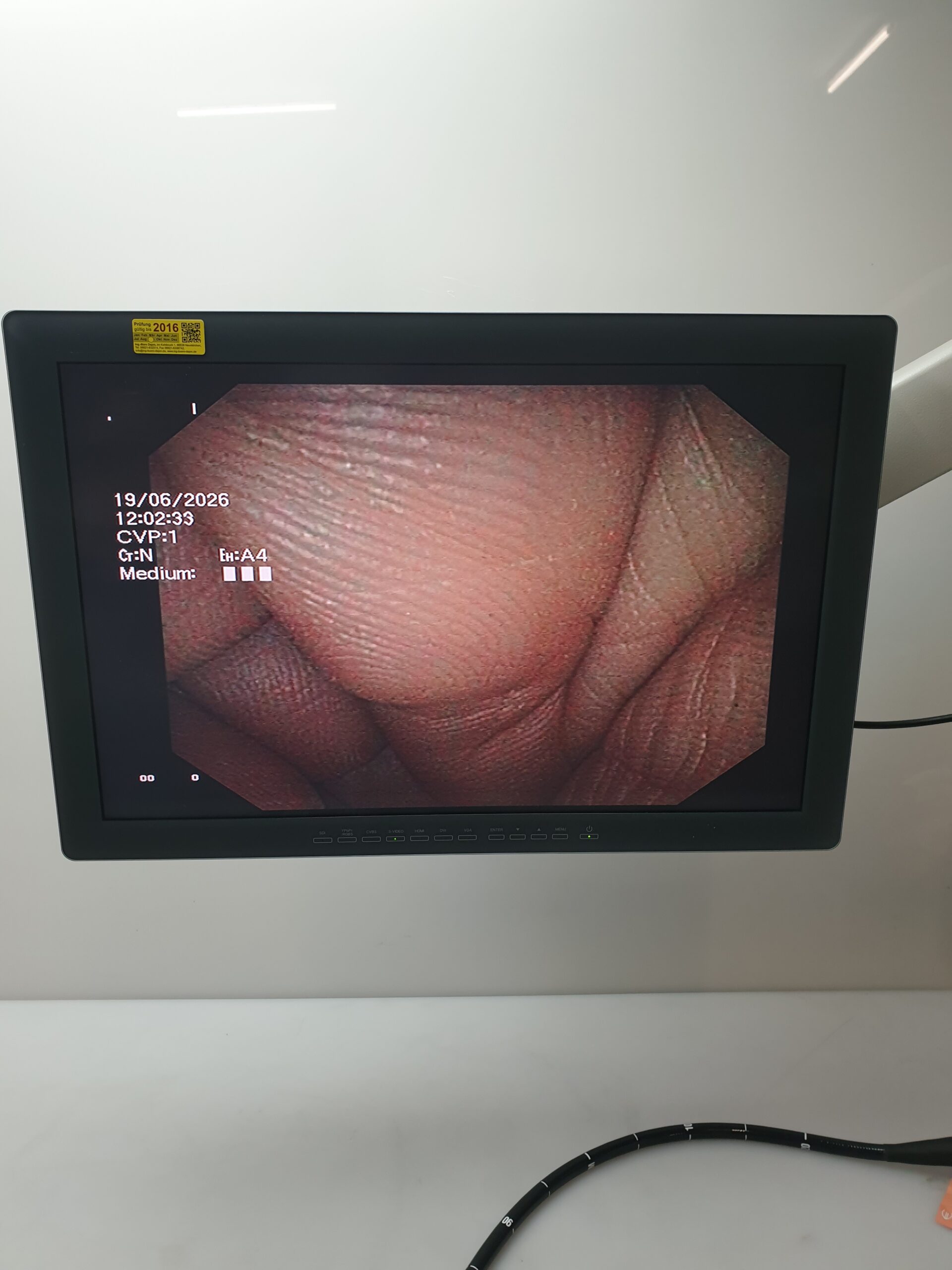 Olympus GF-UCT180 Longitudinales Ultraschallgastroskop – Bild 14