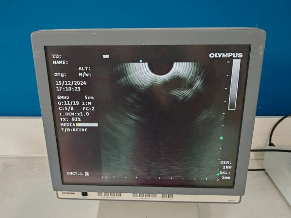 Olympus GF-UCT180 Longitudinales Ultraschallgastroskop - defekt – Bild 22