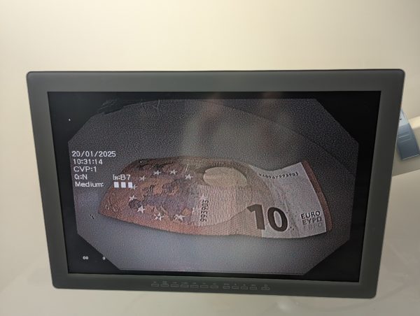 Olympus GIF-H180 HDTV Videogastroskop – Bild 17