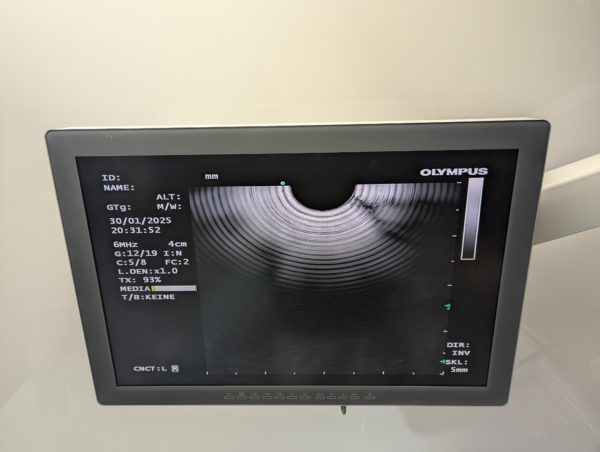 Olympus GF-UCT180 Longitudinales Ultraschallgastroskop – Bild 20