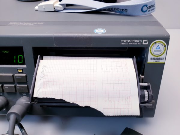 Corometrics 116 Fetal Monitor - CTG mit Aufnehmer – Bild 12