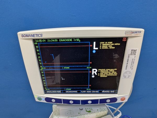 Covidien Somanetics 5100C Invos HirnSomatisches Oximeter + Geräte wagen – Bild 6