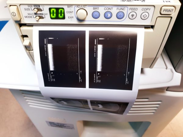 Siemens SONOLINE G20 SLC. 3.5 Konvex, 7.5 Linear – Bild 12