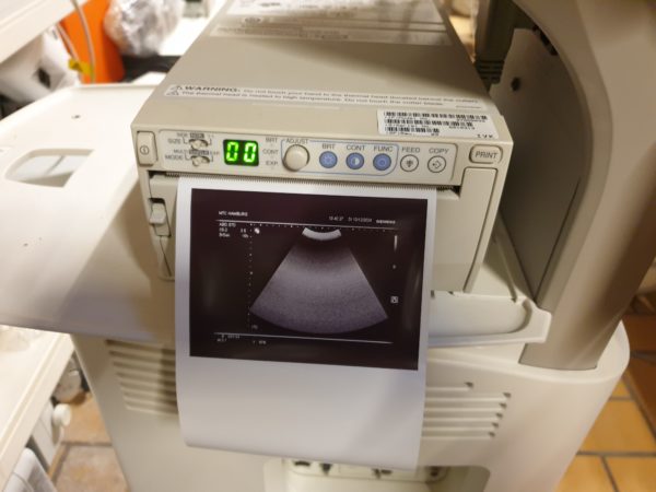 Siemens Probe C5-2 - C5 2  - Konvex Sonde – Bild 5